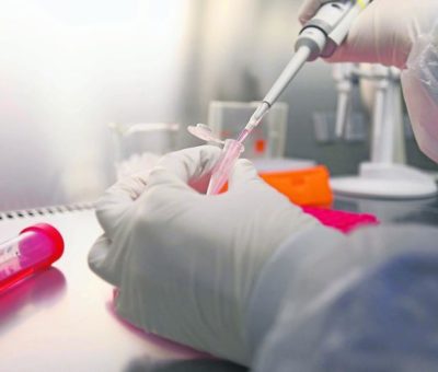 Suman 11 defunciones por Covid-19  en el Estado; hay 79 casos positivos